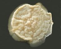 mycobacterium mycobacterium colonies